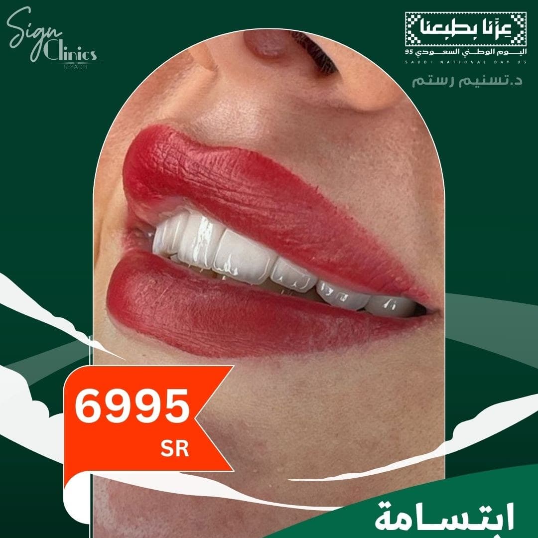 ابتسامة هوليوود